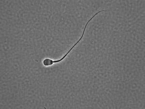 An enlarged image of previously frozen black-footed ferret sperm. Researchers used older frozen sperm to help maintain genetic diversity of the endangered species. Image Courtesy: Rachel Santymire